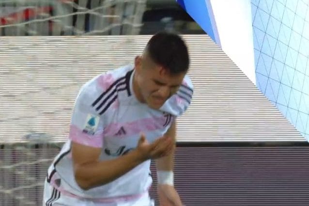Carlos Alcaraz con la testa insanguinata dopo la gomitata di Yerry Mina