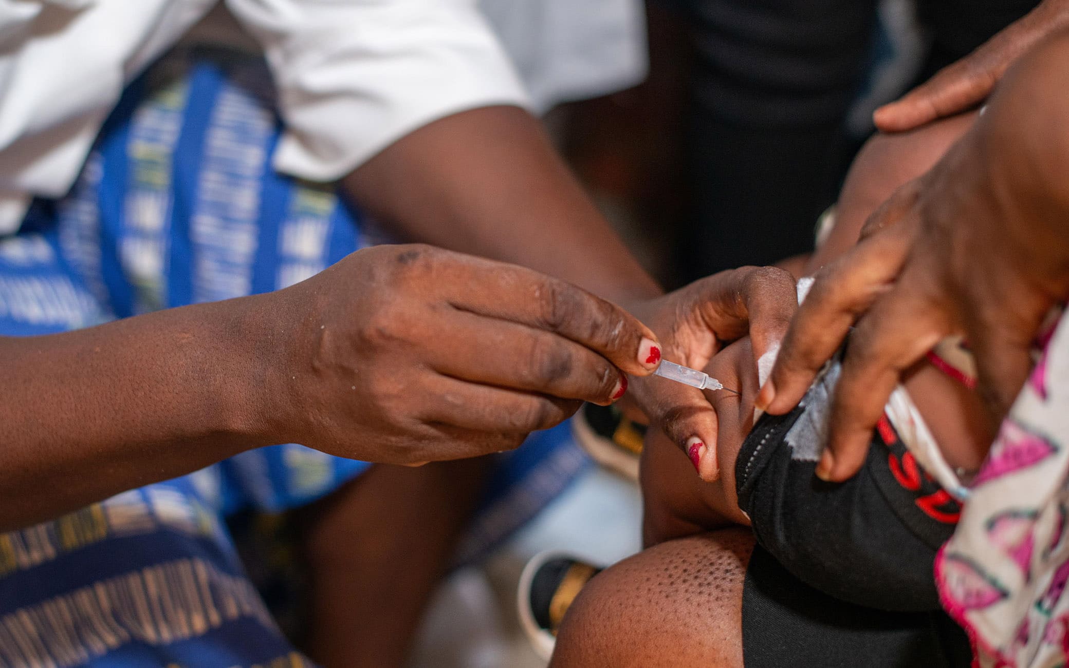 epa11096741 A nurse vaccinates a child against malaria in Nyalla Medical Centre in Douala, Cameroon, 22 January 2024. A new malaria vaccine, known as RTS,S, or Mosquirix, made by GlaxoSmithKline, is being rolled out for the first time as an immunization campaign for children in Cameroon. According to the World Health Organisation, the WHO African Region, with an estimated 233 million cases in 2022, accounted for about 94% of cases globally. Malaria is highly endemic in Cameroon and the WHO estimates that about 11,000 people die from malaria in Cameroon every year. EPA/DONGMO RODRIGUE WILLIAM